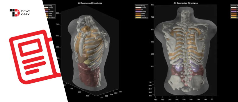 TechDogs-"Midjourney Launches Medical Division With 60-Second Full-Body Ultrasound Scanner"